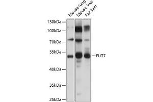 Western blot analysis of extracts of various cell lines, using FUT7 Antibody (ABIN6133982, ABIN6140825, ABIN6140826 and ABIN6224983) at 1:1000 dilution. (FUT7 Antikörper  (AA 100-200))
