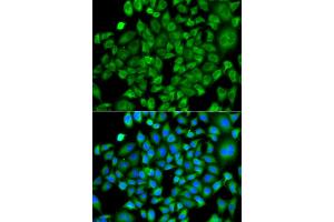 Immunofluorescence analysis of A549 cells using NAA50 antibody. (NAA50 Antikörper)