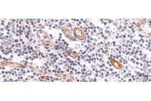 Immunohistochemistry of paraffin-embedded Human tonsil tissue using KCNK15 Polyclonal Antibody at dilution of 1:45(x200) (KCNK15 Antikörper)