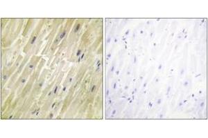 Immunohistochemistry analysis of paraffin-embedded human heart tissue, using M-CK Antibody. (CKM Antikörper  (AA 10-59))