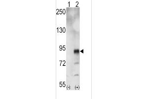 Western blot analysis of EphA5 (arrow) using rabbit polyclonal EphA5 Antibody (ABIN391894 and ABIN2841713). (EPH Receptor A5 Antikörper)