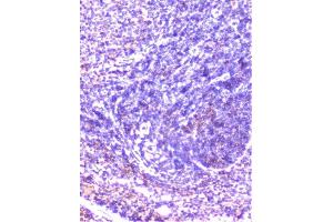 IHC analysis of cortactin using anti-cortactin antibody (ABIN6719306).