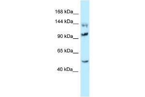 WB Suggested Anti-Hsph1 Antibody Titration: 1. (HSPH1 Antikörper  (C-Term))
