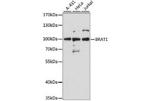 Western blot analysis of extracts of various cell lines, using Brat1 antibody (ABIN6290105) at 1:3000 dilution. (BAAT1 Antikörper)