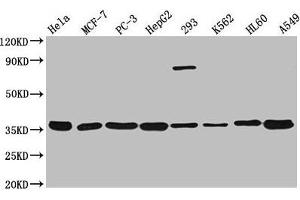 Western Blot Positive WB detected in: Hela whole cell lysate, MCF-7 whole cell lysate, PC-3 whole cell lysate, HepG2 whole cell lysate, 293 whole cell lysate, K562 whole cell lysate, HL60 whole cell lysate, A549 whole cell lysate All lanes: ANXA5 antibody at 1:3000 Secondary Goat polyclonal to rabbit IgG at 1/50000 dilution Predicted band size: 36 kDa Observed band size: 36 kDa (Annexin V Antikörper  (AA 2-320))