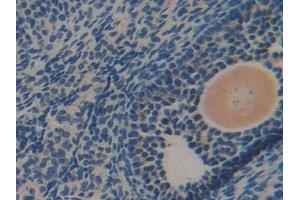 Immunohistochemistry (IHC) image for anti-Dihydrolipoamide Dehydrogenase (DLD) (AA 45-271) antibody (ABIN7432892)