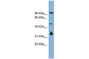 MAK10 antibody used at 1 ug/ml to detect target protein. (MAK10/NAA35 Antikörper  (N-Term))