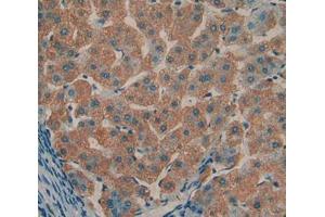 Used in DAB staining on fromalin fixed paraffin- embedded liver tissue (TOLLIP Antikörper  (AA 28-261))