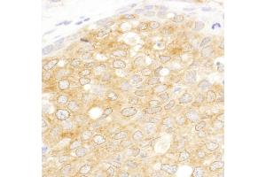anti-eIF2beta/EIF2S2 (AA 283-333) antibody