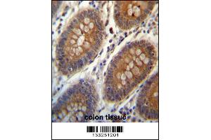 TRIM38 Antibody immunohistochemistry analysis in formalin fixed and paraffin embedded human colon tissue followed by peroxidase conjugation of the secondary antibody and DAB staining. (TRIM38 Antikörper  (C-Term))