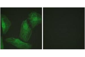 Immunofluorescence analysis of HeLa cells, using Smad2 (Ab-220) Antibody. (SMAD2 Antikörper  (AA 186-235))