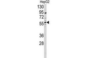 Western Blotting (WB) image for anti-24-Dehydrocholesterol Reductase (DHCR24) antibody (ABIN3001663) (Seladin 1 Antikörper)