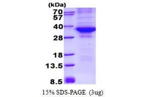 Image no. 1 for Cyclin-Dependent Kinase 4 (CDK4) protein (His tag) (ABIN1098680)