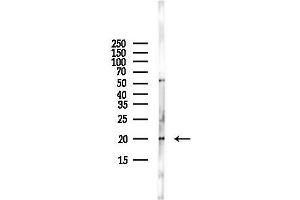 anti-Claudin 7 (CLDN7) (C-Term) antibody