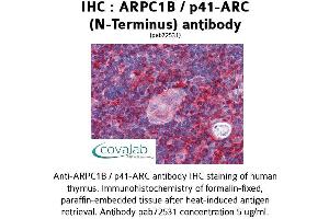Image no. 1 for anti-Actin Related Protein 2/3 Complex, Subunit 1B, 41kDa (ARPC1B) (N-Term) antibody (ABIN1731962) (ARPC1B Antikörper  (N-Term))
