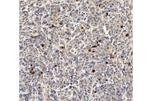 Immunohistochemistry (Paraffin-embedded Sections) (IHC (p)) image for anti-Caspase 3 (CASP3) (cleaved) antibody (ABIN7073336)