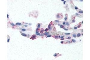 Immunohistochemical (Formalin/PFA-fixed paraffin-embedded sections) staining in human lung (neutrophils) with EMR2 polyclonal antibody . (EMR2 Antikörper)