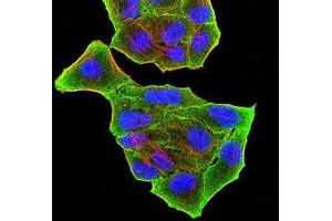 Immunocytochemistry (ICC) image for anti-PR Domain Containing 5 (PRDM5) (AA 1-100) antibody (ABIN5874500) (PRDM5 Antikörper  (AA 1-100))