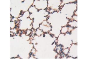 IHC-P analysis of Rat Lung Tissue, with DAB staining. (MMP12 Antikörper  (AA 20-99))