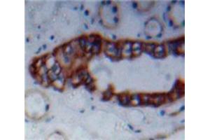 Immunohistochemistry (IHC) image for anti-Nectin cell adhesion molecule 3 (NECTIN3) (AA 90-293) antibody (ABIN1860377)