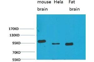 Western Blot (WB) analysis of 1)Mouse Brain Tissue, 2)HeLa, 3)Rat Brain Tissue with EphA1 Rabbit Polyclonal Antibody diluted at 1:2000.