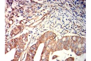 Immunohistochemistry (IHC) image for anti-Fibrinogen-Like 1 (FGL1) (AA 23-312) antibody (ABIN7193608)