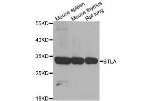 Western blot analysis of extracts of various cell lines, using BTLA antibody. (BTLA Antikörper  (AA 31-241))