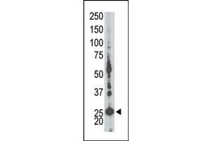 Image no. 1 for anti-Adenylate Kinase 5 (AK5) (N-Term) antibody (ABIN360616) (Adenylate Kinase 5 Antikörper  (N-Term))