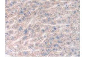 IHC-P analysis of Mouse Liver Tissue, with DAB staining. (DDX58 Antikörper  (AA 1-211))