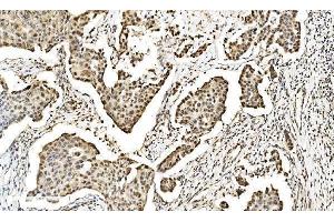 IHC analysis of LSM2 using anti-LSM2 antibody (ABIN7602832).