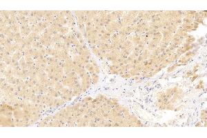 Detection of VEGFB in Human Liver Tissue using Polyclonal Antibody to Vascular Endothelial Growth Factor B (VEGFB)