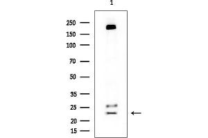 Western blot analysis of lysates from Rat brain, using GUCA1A Mouse Monoclonal Antibody at 1/1000 dilution. (GCAP1 Antikörper)
