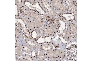 Immunohistochemical staining of human kidney with TBC1D12 polyclonal antibody  shows strong nucelar positivity in cells in tubules. (TBC1D12 Antikörper)