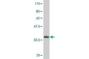 Western Blot detection against Immunogen (36. (SP1 Antikörper  (AA 522-618))