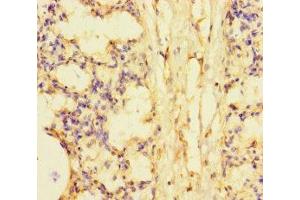 Immunohistochemistry of paraffin-embedded human lung tissue using ABIN7169732 at dilution of 1:100