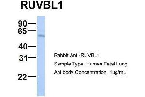 Host:  Rabbit  Target Name:  RUVBL1  Sample Type:  Human Fetal Lung  Antibody Dilution:  1. (RUVBL1 Antikörper  (N-Term))