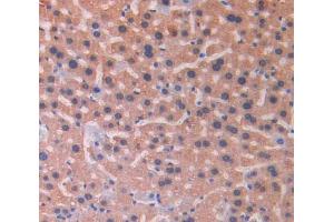 IHC-P analysis of liver tissue, with DAB staining. (IL18RAP Antikörper  (AA 396-548))