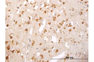 Immunoperoxidase of monoclonal antibody to TRIM25 on formalin-fixed paraffin-embedded human cerebral cortex. (TRIM25 Antikörper  (AA 211-310))