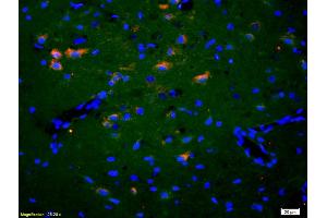 Formalin-fixed and paraffin-embedded rat brain labeled with Anti-EphA2/Eph receptor A2 Polyclonal Antibody, Unconjugated (ABIN669201) 1:200, overnight at 4°C, The secondary antibody was Goat Anti-Rabbit IgG, Cy3 conjugated used at 1:200 dilution for 40 minutes at 37°C.