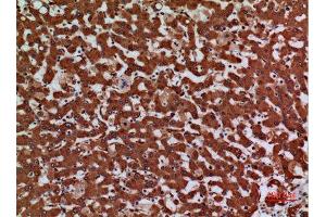 Immunohistochemistry (IHC) image for anti-Laminin, gamma 2 (LAMC2) (C-Term) antibody (ABIN3187887)