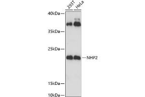 Western blot analysis of extracts of various cell lines, using NHP2 Antibody (ABIN6133224, ABIN6144622, ABIN6144623 and ABIN6221656) at 1:3000 dilution.