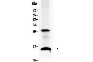 Western blot analysis of SDF1 using anti-SDF1 antibody . (CXCL12 Antikörper)