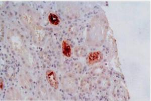 Immunohistochemistry of paraffin-embedded sections (kidney) Immunohistochemistry staining of kidney allograft biopsy (paraffin-embedded sections) with anti-human HLA-G (MEM-G/2). (HLAG Antikörper)