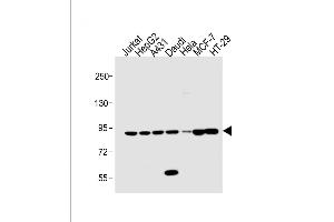 STAT1 Antikörper  (C-Term)