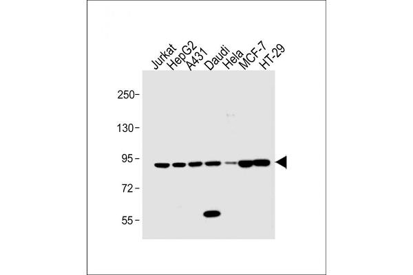 STAT1 Antikörper  (C-Term)