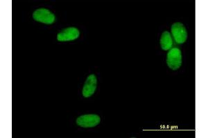 Immunofluorescence of purified MaxPab antibody to POLD2 on HeLa cell. (POLD2 Antikörper  (AA 1-469))