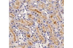 Immunohistochemistry analysis of paraffin-embedded rat kidney using,SLC22A1 (ABIN7075663) at dilution of 1: 1200 (SLC22A1 Antikörper)