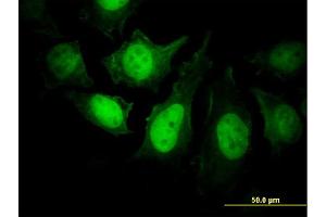 Immunofluorescence of monoclonal antibody to PPP3R1 on HeLa cell. (PPP3R1 Antikörper  (AA 1-170))