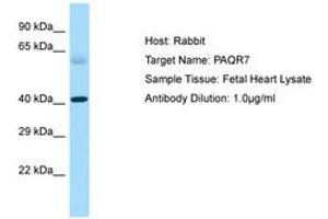 Image no. 1 for anti-Progestin and AdipoQ Receptor Family Member VII (PAQR7) (C-Term) antibody (ABIN6750220)