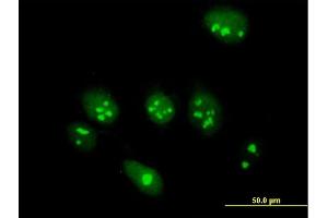 Immunofluorescence of purified MaxPab antibody to ABT1 on HeLa cell. (Activator of Basal Transcription 1 Antikörper  (AA 1-272))